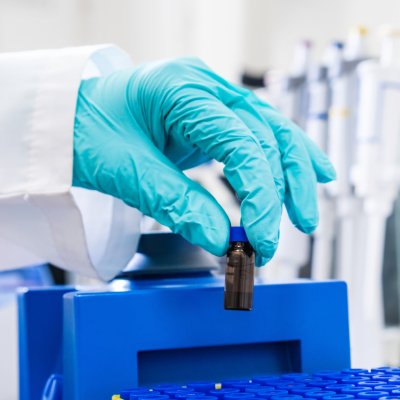 HPLC Cromatografía